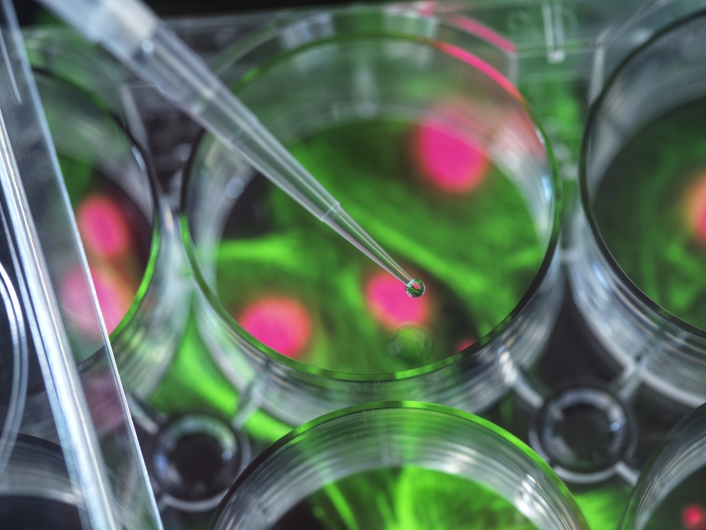 Alzheimer’s Disease (AD) Model: APP Processing Assay Cell Line