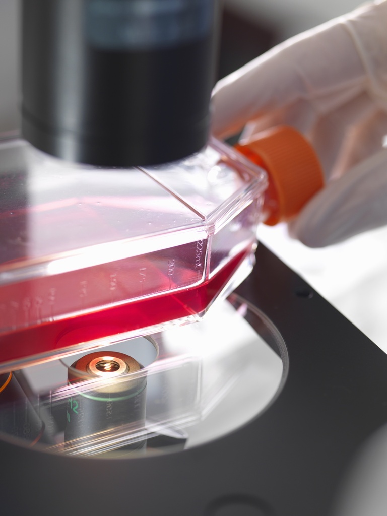 Claudin18.2 (CLDN18.2) CHO-K1 Cell Line